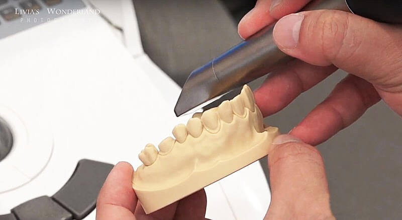最先進的數位全彩口腔掃瞄機-免牙模快速取得牙齒模型數位檔