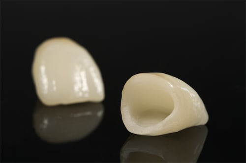 抽神經-根管治療-牙齒變黑-牙齒美白-根管治療牙套-全瓷冠-台中-劉得廷醫師