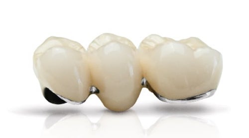 抽神經-根管治療-牙齒變黑-牙齒美白-烤瓷金屬牙冠-台中-劉得廷醫師